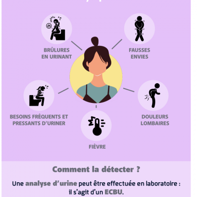 Cystite chez la femme : savoir reconnaître et agir rapidement