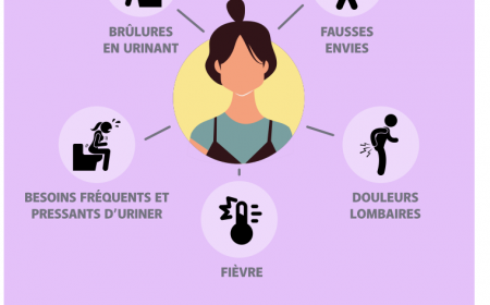 Cystite chez la femme : savoir reconnaître et agir rapidement
